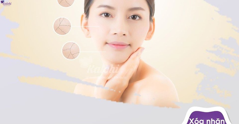 LẤY LẠI TUỔI 20 VỚI TIÊM BOTOX XÓA NẾP NHĂN AN TOÀN CHỈ CÓ TẠI KALOHI BEAUTY?