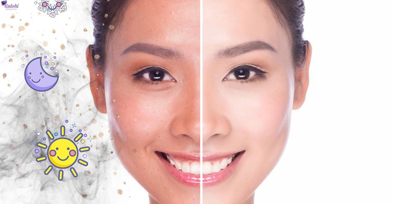 “Trắng như tuyết – Đẹp như hoa” với phương pháp Phủ trắng pha lê da
