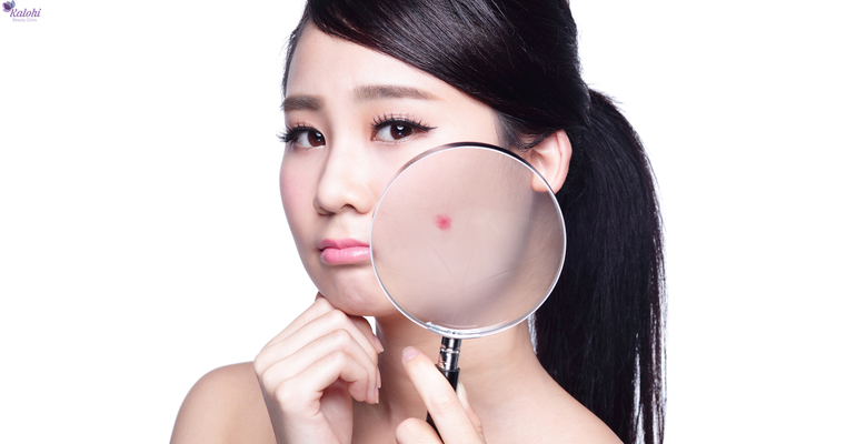 Có phải Spa trị mụn giá rẻ HCM nào cũng kém chất lượng?