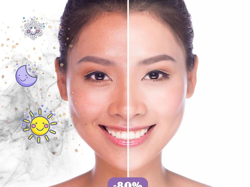 [TƯ VẤN] Nơi Phủ trắng da an toàn không bắt nắng?